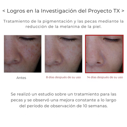Crema TX - Para Manchas Oscuras e Hiperpigmentación